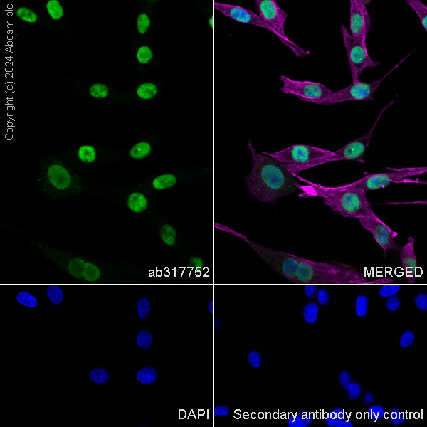 Immunocytochemistry/ Immunofluorescence - Anti-MCM2 antibody [RM1146] (AB317752)