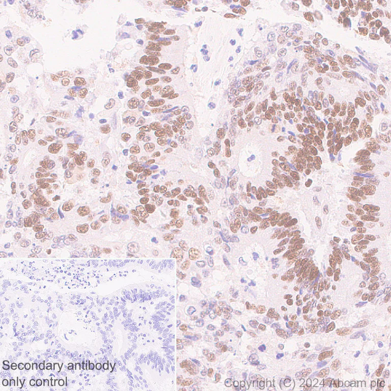 Immunohistochemistry (Formalin/PFA-fixed paraffin-embedded sections) - Anti-MCM2 antibody [RM1146] (AB317752)
