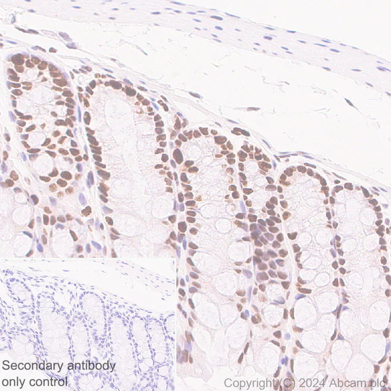 Immunohistochemistry (Formalin/PFA-fixed paraffin-embedded sections) - Anti-MCM2 antibody [RM1146] (AB317752)