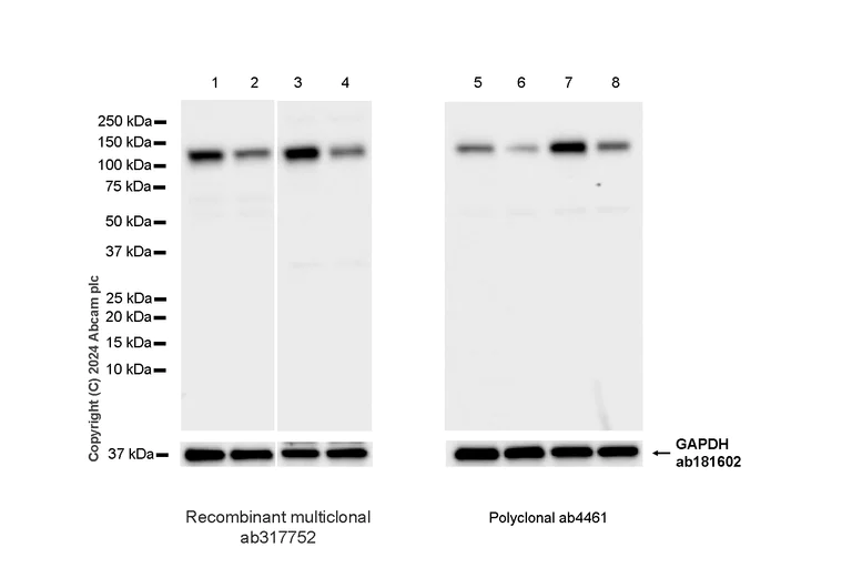 Western blot - Anti-MCM2 antibody [RM1146] (AB317752)