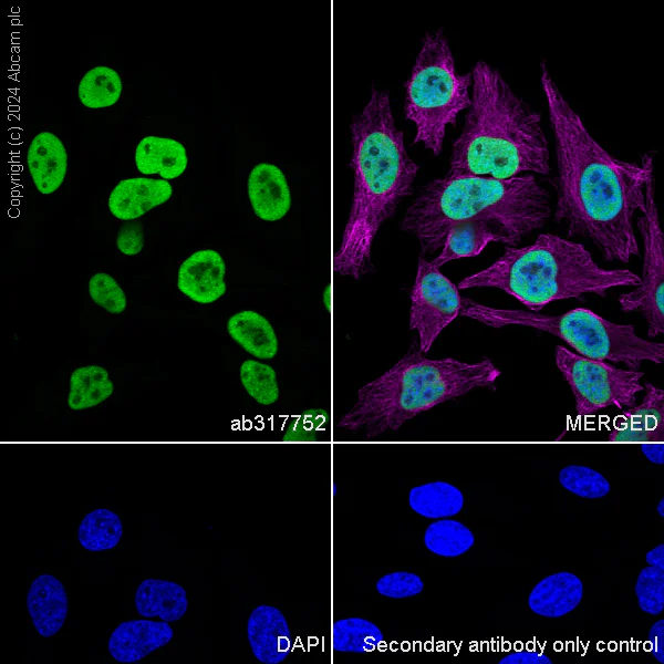 Immunocytochemistry/ Immunofluorescence - Anti-MCM2 antibody [RM1146] - BSA and Azide free (AB317753)