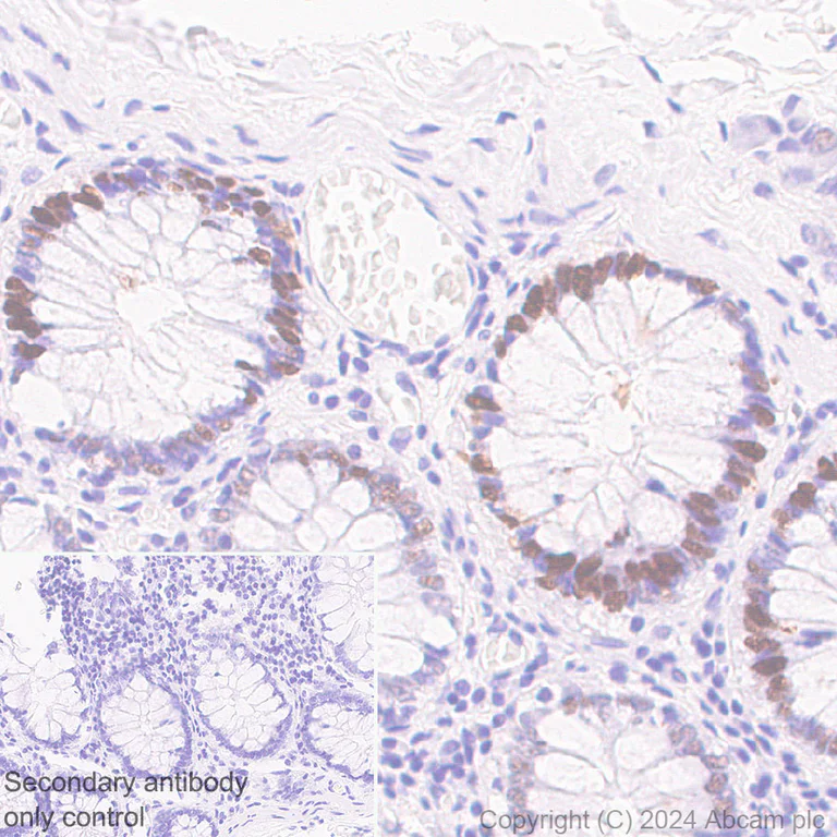 Immunohistochemistry (Formalin/PFA-fixed paraffin-embedded sections) - Anti-MCM2 antibody [RM1146] - BSA and Azide free (AB317753)