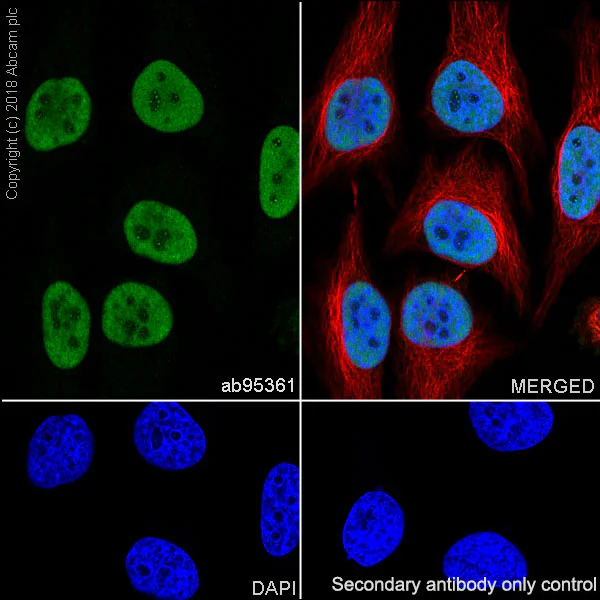 Immunocytochemistry/ Immunofluorescence - Anti-MCM2 antibody [SP85] (AB95361)