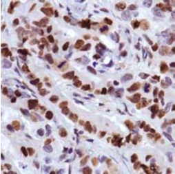 Immunohistochemistry (Formalin/PFA-fixed paraffin-embedded sections) - Anti-MCM2 antibody [SP85] (AB95361), expandable thumbnail