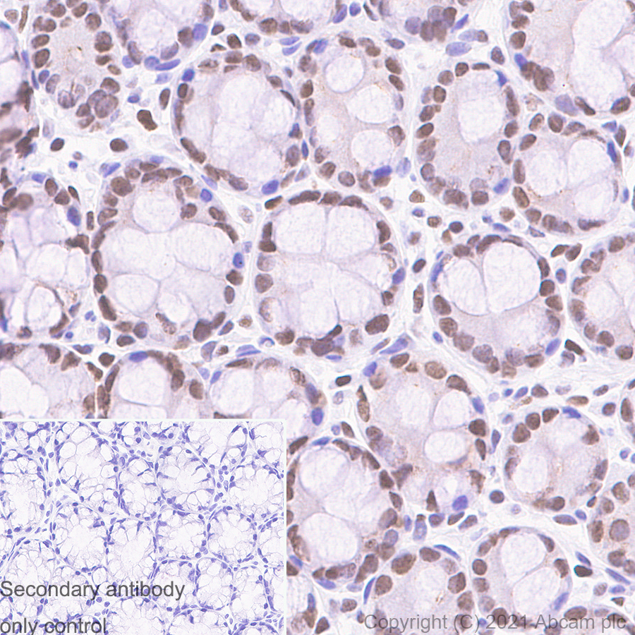 Immunohistochemistry (Formalin/PFA-fixed paraffin-embedded sections) - Anti-MCM2 antibody [SP85] (ab95361), expandable thumbnail
