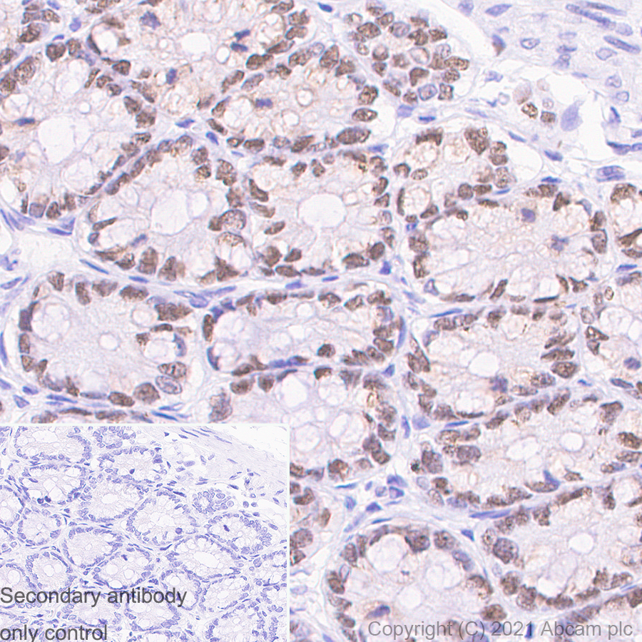 Immunohistochemistry (Formalin/PFA-fixed paraffin-embedded sections) - Anti-MCM2 antibody [SP85] (ab95361), expandable thumbnail
