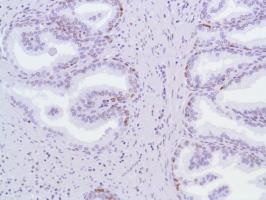 Immunohistochemistry (Formalin/PFA-fixed paraffin-embedded sections) - Anti-MCM2 antibody [SP85] (ab95361), expandable thumbnail