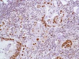 Immunohistochemistry (Formalin/PFA-fixed paraffin-embedded sections) - Anti-MCM2 antibody [SP85] (AB95361)