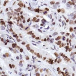 Immunohistochemistry (Formalin/PFA-fixed paraffin-embedded sections) - Anti-MCM2 antibody [SP85] - BSA and Azide free (AB240933)