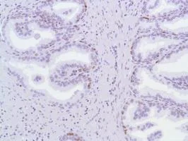 Immunohistochemistry (Formalin/PFA-fixed paraffin-embedded sections) - Anti-MCM2 antibody [SP85] - BSA and Azide free (AB240933)