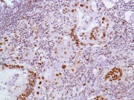 Immunohistochemistry (Formalin/PFA-fixed paraffin-embedded sections) - Anti-MCM2 antibody [SP85] - BSA and Azide free (AB240933)