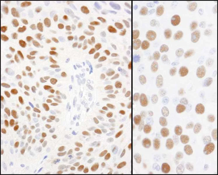 Immunohistochemistry (Formalin/PFA-fixed paraffin-embedded sections) - Anti-MCM2 (phospho S108) antibody (AB264114)