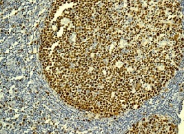 Immunohistochemistry (Formalin/PFA-fixed paraffin-embedded sections) - Anti-MCM2 (phospho S139) antibody [EPR10819] (AB170873), expandable thumbnail