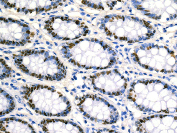 Immunohistochemistry (Formalin/PFA-fixed paraffin-embedded sections) - Anti-MCM2 (phospho S139) antibody [EPR10819] (AB170873), expandable thumbnail