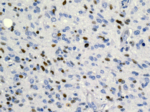 Immunohistochemistry (Formalin/PFA-fixed paraffin-embedded sections) - Anti-MCM2 (phospho S139) antibody [EPR10819] (AB170873), expandable thumbnail