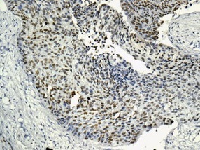 Immunohistochemistry (Formalin/PFA-fixed paraffin-embedded sections) - Anti-MCM2 (phospho S139) antibody [EPR10819] (ab170873), expandable thumbnail