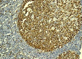 Immunohistochemistry (Formalin/PFA-fixed paraffin-embedded sections) - Anti-MCM2 (phospho S139) antibody [EPR10819] - BSA and Azide free (AB249554)