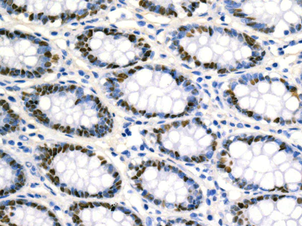 Immunohistochemistry (Formalin/PFA-fixed paraffin-embedded sections) - Anti-MCM2 (phospho S139) antibody [EPR10819] - BSA and Azide free (AB249554)