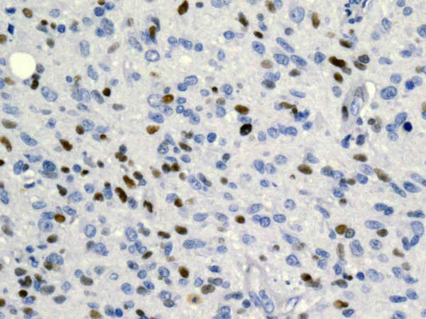 Immunohistochemistry (Formalin/PFA-fixed paraffin-embedded sections) - Anti-MCM2 (phospho S139) antibody [EPR10819] - BSA and Azide free (AB249554)