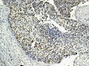 Immunohistochemistry (Formalin/PFA-fixed paraffin-embedded sections) - Anti-MCM2 (phospho S139) antibody [EPR10819] - BSA and Azide free (AB249554)