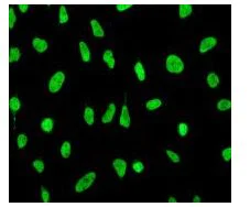 Immunocytochemistry/ Immunofluorescence - Anti-MCM2 (phospho S27) antibody [EPR4119] (AB109459)