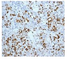 Immunohistochemistry (Formalin/PFA-fixed paraffin-embedded sections) - Anti-MCM2 (phospho S27) antibody [EPR4119] (AB109459), expandable thumbnail