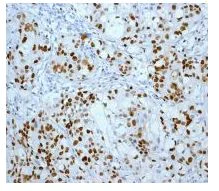 Immunohistochemistry (Formalin/PFA-fixed paraffin-embedded sections) - Anti-MCM2 (phospho S27) antibody [EPR4119] (AB109459)
