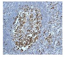 Immunohistochemistry (Formalin/PFA-fixed paraffin-embedded sections) - Anti-MCM2 (phospho S27) antibody [EPR4119] (AB109459), expandable thumbnail