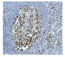 Immunohistochemistry (Formalin/PFA-fixed paraffin-embedded sections) - Anti-MCM2 (phospho S27) antibody [EPR4119] (AB109459)