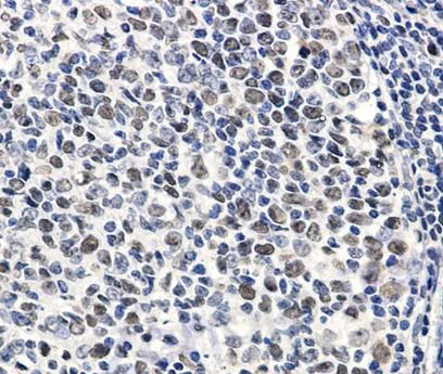Immunohistochemistry (Formalin/PFA-fixed paraffin-embedded sections) - Anti-MCM2 (phospho S27) antibody [SR1107] (AB326666)