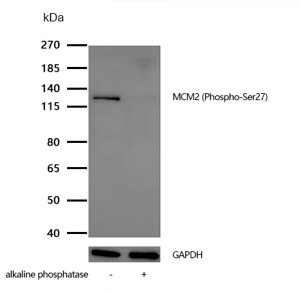 Western blot - Anti-MCM2 (phospho S27) antibody [SR1107] (AB326666)