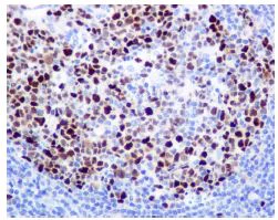 Immunohistochemistry (Formalin/PFA-fixed paraffin-embedded sections) - Anti-MCM2 (phospho S40) antibody [EPR4170(2)] - BSA and Azide free (AB240052)