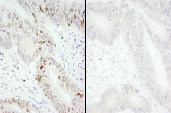 Immunohistochemistry (Formalin/PFA-fixed paraffin-embedded sections) - Anti-MCM2 (phospho S40 + S41) antibody (AB70371)