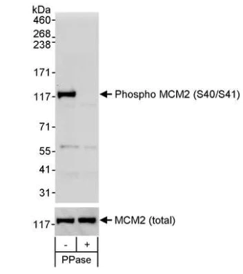 Western blot - Anti-MCM2 (phospho S40 + S41) antibody (AB70371)
