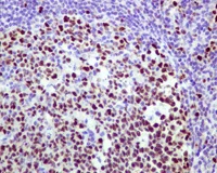 Immunohistochemistry (Formalin/PFA-fixed paraffin-embedded sections) - Anti-MCM2 (phospho S41) antibody [EPR4171] - BSA and Azide free (AB247815)