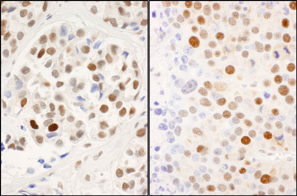 Immunohistochemistry (Formalin/PFA-fixed paraffin-embedded sections) - Anti-MCM2 (phospho S53) antibody (AB70367)