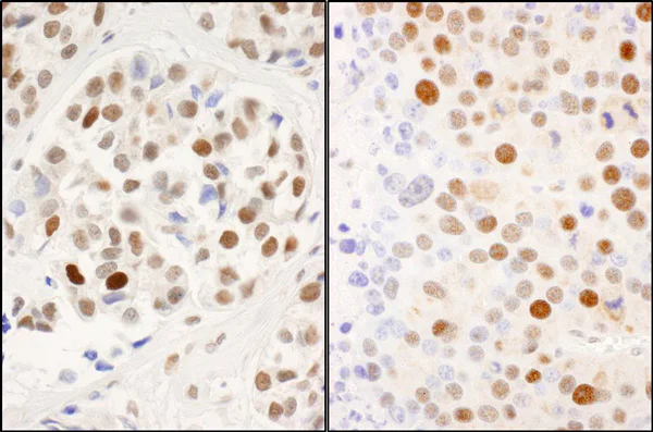 Immunohistochemistry (Formalin/PFA-fixed paraffin-embedded sections) - Anti-MCM2 (phospho S53) antibody (AB70367)