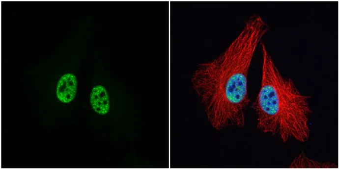 Immunocytochemistry/ Immunofluorescence - Anti-MCM3 antibody (AB272877)