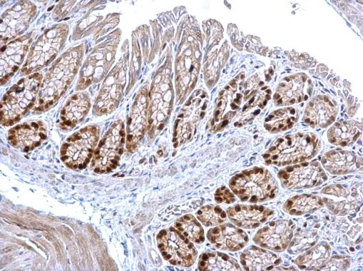 Immunohistochemistry (Formalin/PFA-fixed paraffin-embedded sections) - Anti-MCM3 antibody (AB272877)