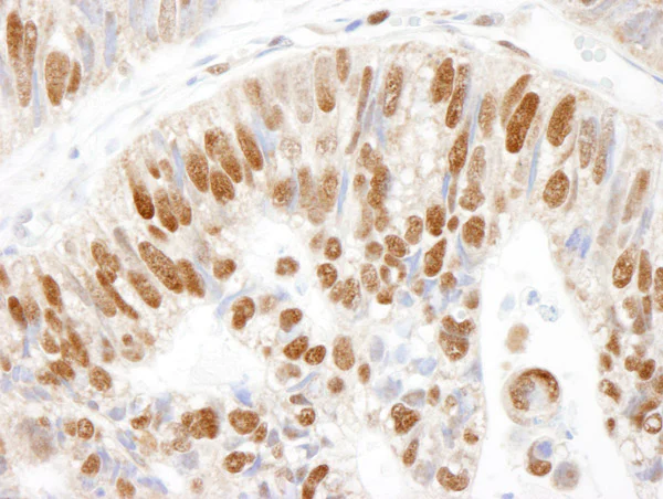 Immunohistochemistry (Formalin/PFA-fixed paraffin-embedded sections) - Anti-MCM3 antibody (AB4460)