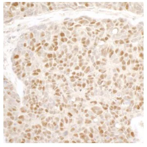 Immunohistochemistry (Formalin/PFA-fixed paraffin-embedded sections) - Anti-MCM3 antibody (AB4460)