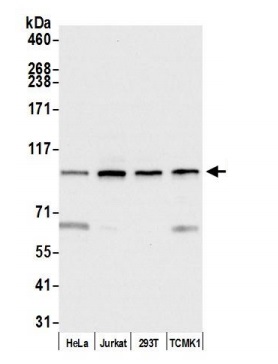 Anti-MCM3 antibody