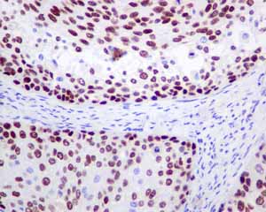 Immunohistochemistry (Formalin/PFA-fixed paraffin-embedded sections) - Anti-MCM3 antibody [EPR7080] (AB128923)