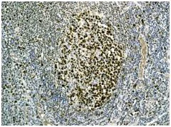 Immunohistochemistry (Formalin/PFA-fixed paraffin-embedded sections) - Anti-MCM3 antibody [EPR7080] (AB128923)