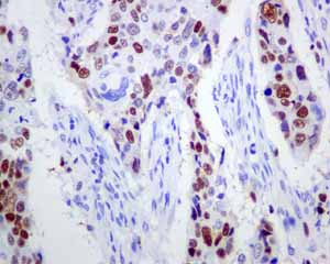 Immunohistochemistry (Formalin/PFA-fixed paraffin-embedded sections) - Anti-MCM3 antibody [EPR7080] - BSA and Azide free (ab248222), expandable thumbnail