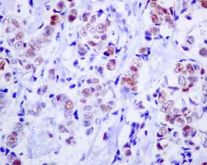Immunohistochemistry (Formalin/PFA-fixed paraffin-embedded sections) - Anti-MCM3 antibody [EPR7080] - BSA and Azide free (AB248222)