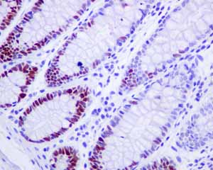 Immunohistochemistry (Formalin/PFA-fixed paraffin-embedded sections) - Anti-MCM3 antibody [EPR7080] - BSA and Azide free (AB248222), expandable thumbnail