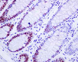 Immunohistochemistry (Formalin/PFA-fixed paraffin-embedded sections) - Anti-MCM3 antibody [EPR7080] - BSA and Azide free (AB248222)