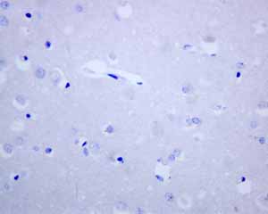 Immunohistochemistry (Formalin/PFA-fixed paraffin-embedded sections) - Anti-MCM3 antibody [EPR7080] - BSA and Azide free (ab248222), expandable thumbnail