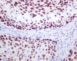 Immunohistochemistry (Formalin/PFA-fixed paraffin-embedded sections) - Anti-MCM3 antibody [EPR7080] - BSA and Azide free (AB248222)